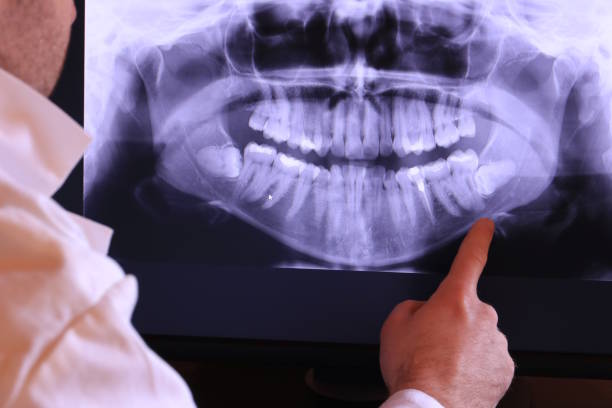 Best Cosmetic Emergency Dentistry in Clear Lake, WA