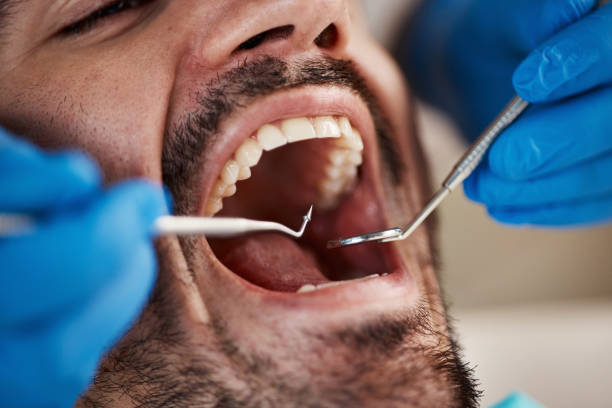 Best Pediatric Emergency Dentist in Clear Lake, WA